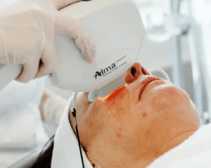 laser ofipl therapie thumbnail