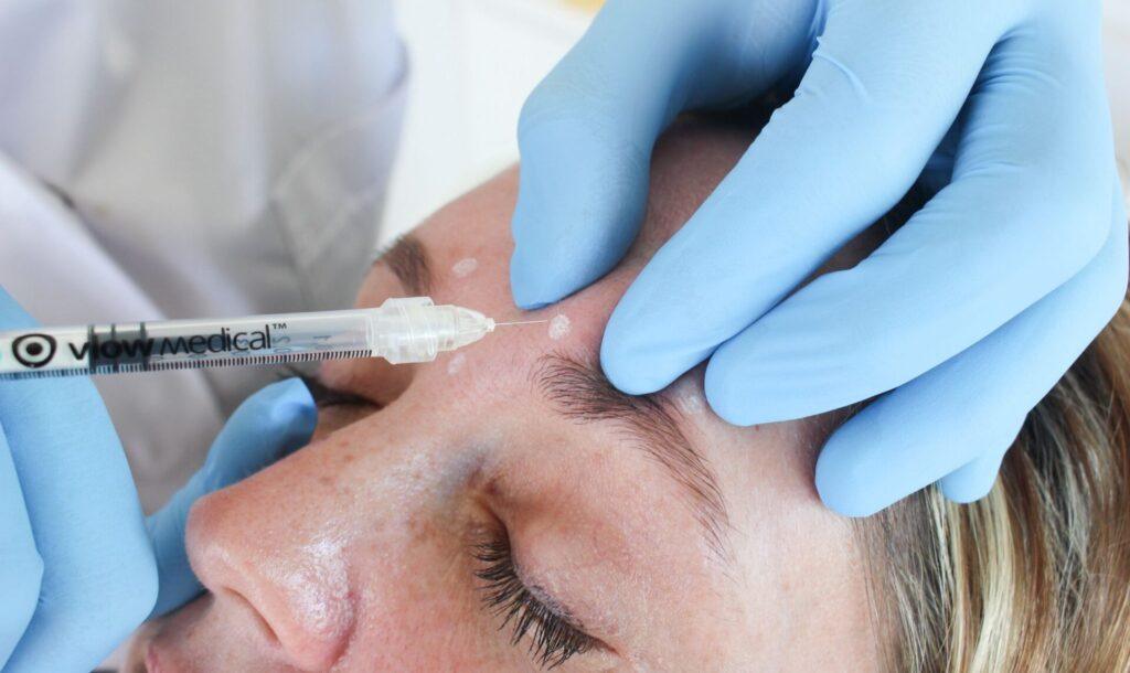 Botox behandeling huidpraktijk ilp