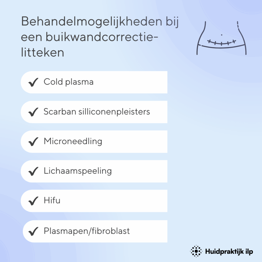 Behandelmogelijkheden bij een buikwandcorrectie-litteken